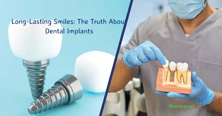 Dental Implant