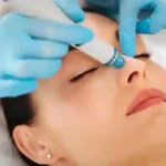 Everything You Need to Know About the Hydrafacial Procedure